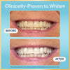 Before and after showing teeth whitening results with a blue background and text indicating clinical provenance.