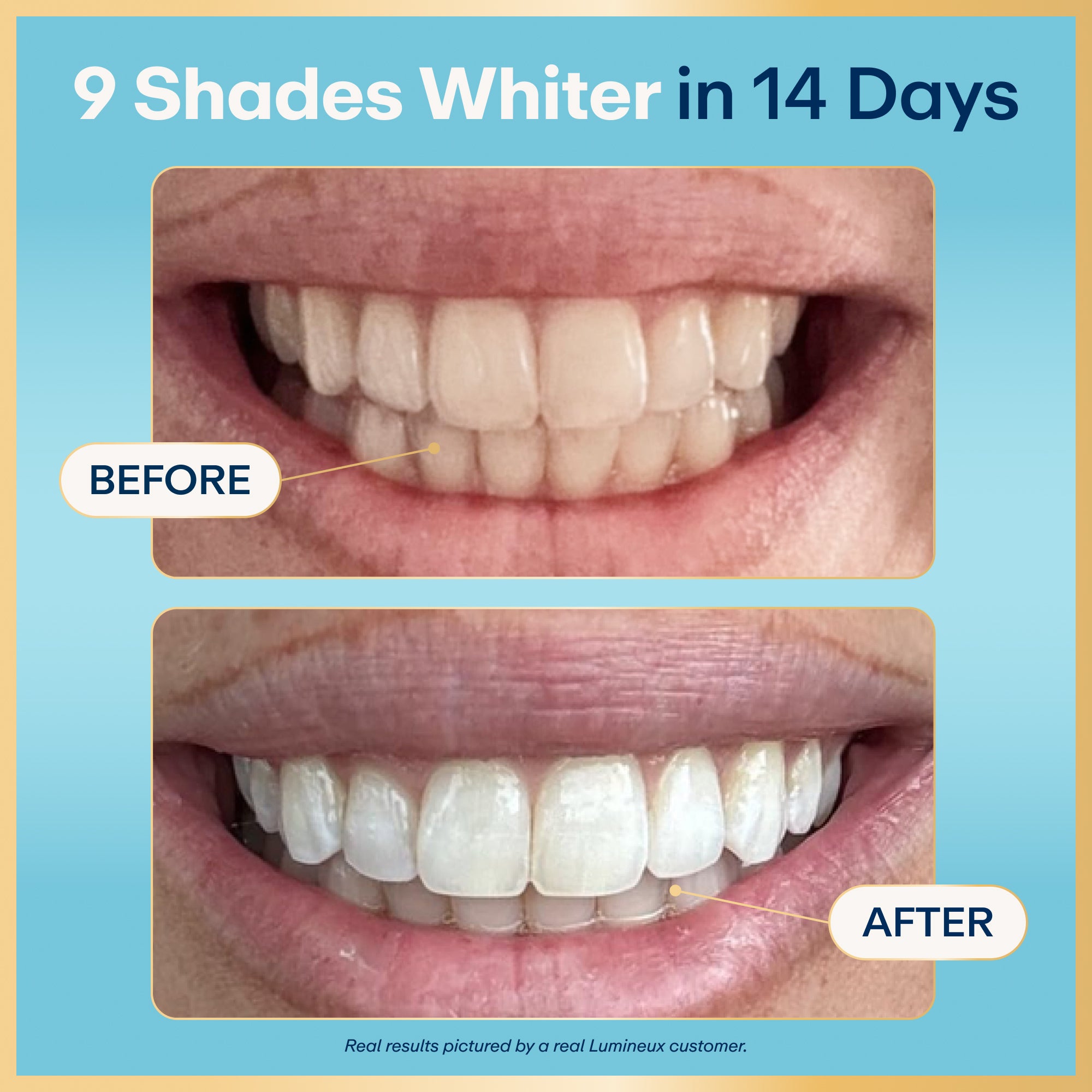 Lumineux Teeth Whitening Strips - Thumbnail 3