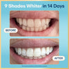 Before and after comparison of teeth whitening with text '9 Shades Whiter in 14 Days' on a blue background.